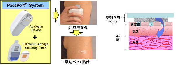 PassPort™ Systemの特徴